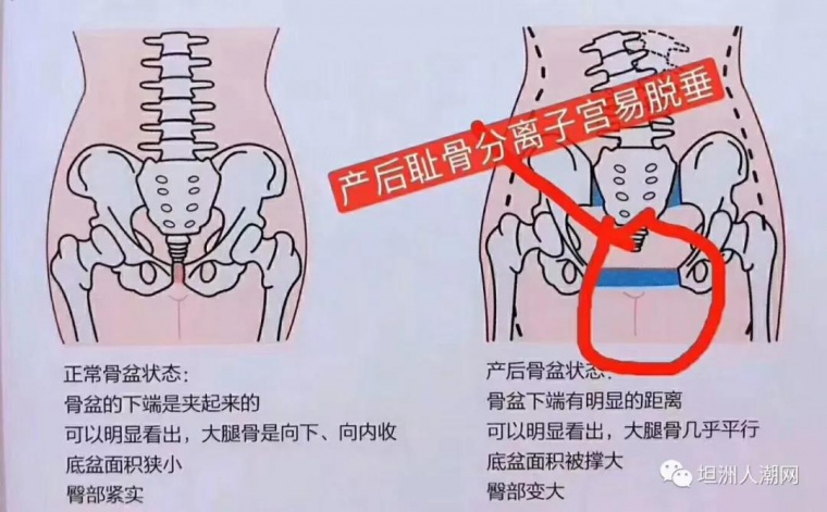 坦洲妈妈,仅需99元享受专业的产后修复!限30名,先抢先得!